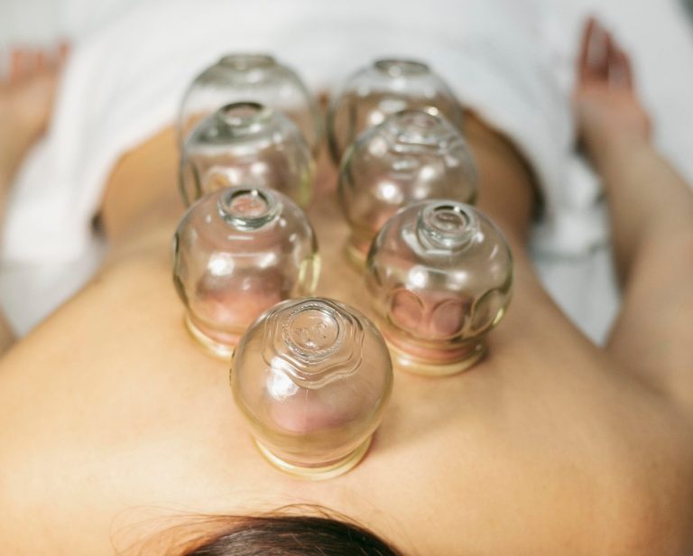 Schröpfgläser auf dem Rücken – Schröpfmassage Schleiklang